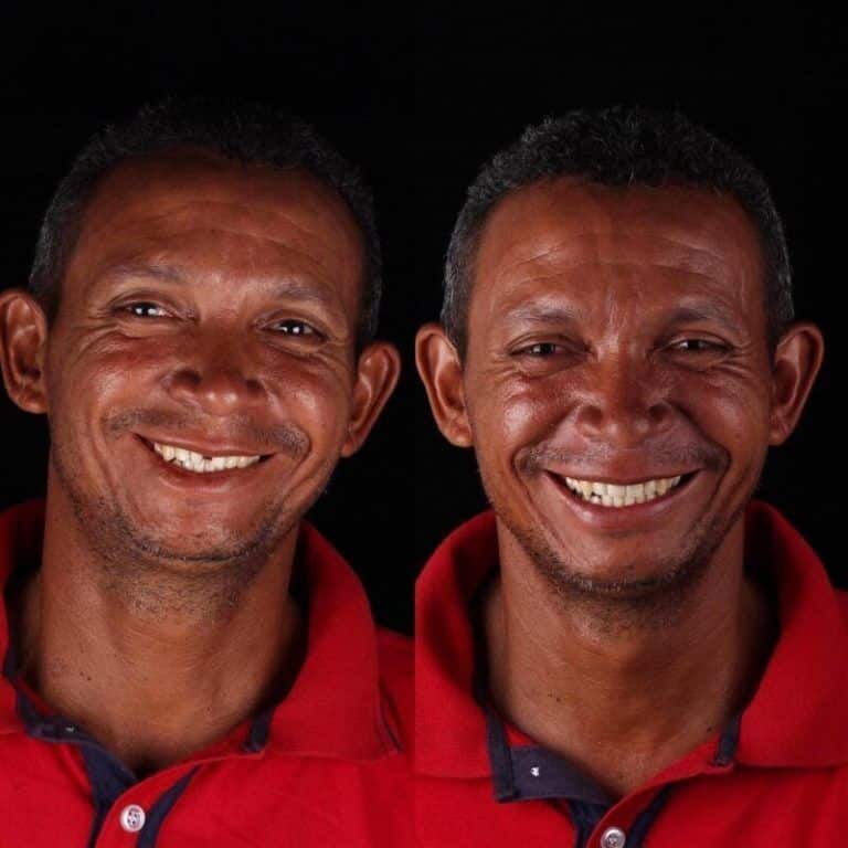 Зъболекарят показа как се променя усмивката на човек, който най-накрая е излекувал болни зъби 7