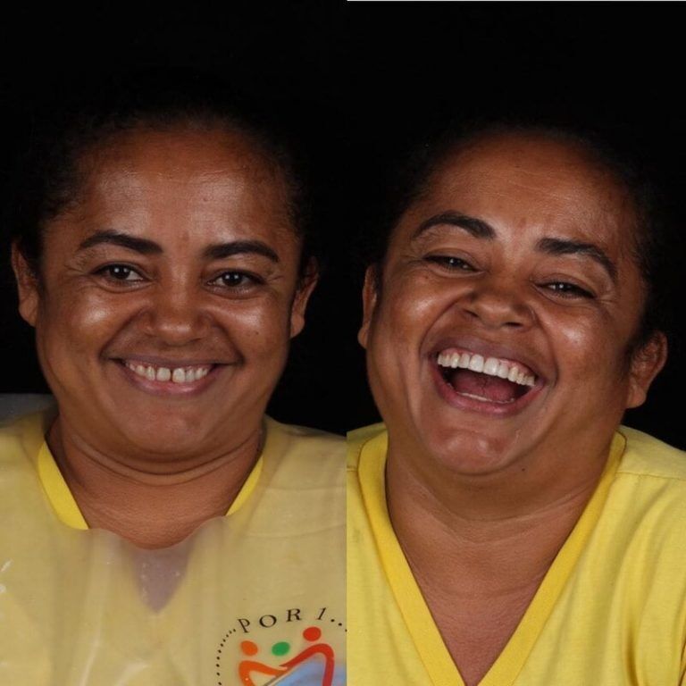 Зъболекарят показа как се променя усмивката на човек, който най-накрая е излекувал болни зъби 5