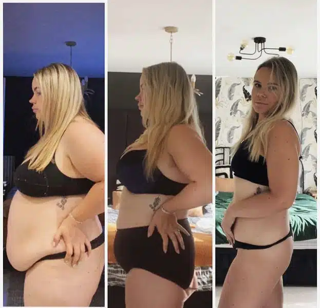 Жена похарчи 40000 лв, за да отслабне с 20 размера! Промяната е невероятна (СНИМКИ преди и след) 1