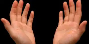 Вашите длани могат да ви предупредят за сериозно заболяване 1
