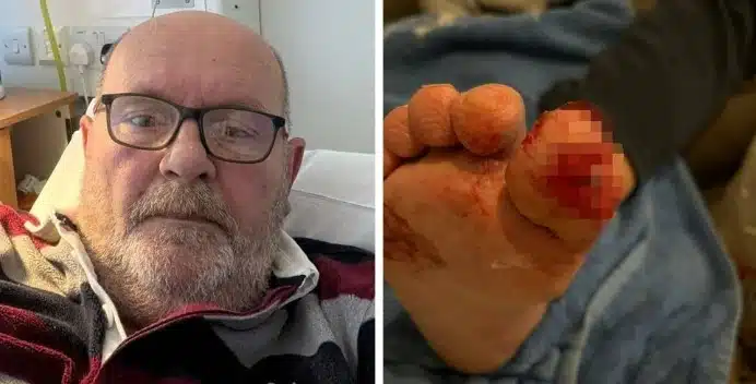 Палаво кученце сдъвка пръста на крака на стопанина си и спаси живота на мъжа! Невероятно, но факт! 2