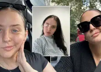 Жена си мислеше, че просто е настинала, а се оказа, че лицето и е парализирано 12