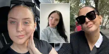 Жена си мислеше, че просто е настинала, а се оказа, че лицето и е парализирано 2
