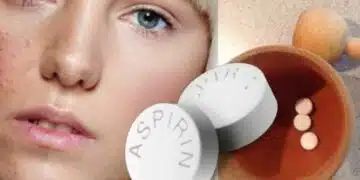 Аспиринът може да направи чудо за кожата ти - правиш го три пъти, казваш чао на несъвършенствата 1