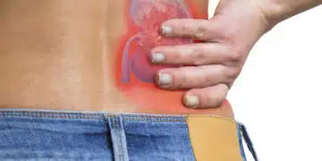 Kidney and low back pain