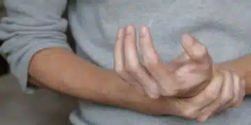 Странен симптом в ръцете и краката ви може да е знак, че имате недостиг на ключов витамин 7