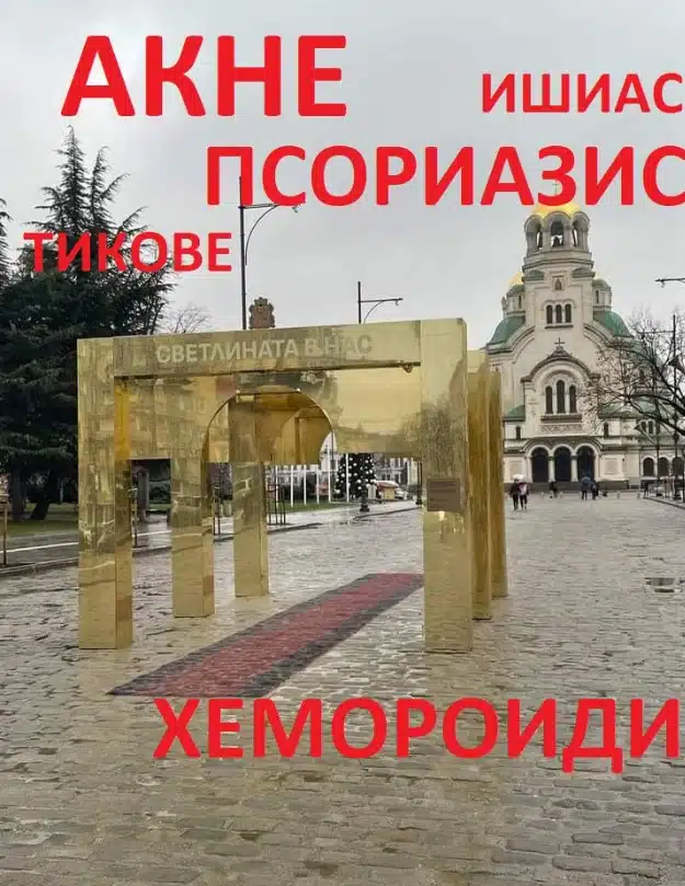 Златни арки на пъпа на София са причината столичани да изпаднат в шок, неочаквана кражба ги беляза 8