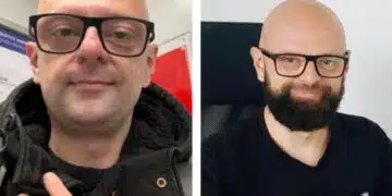 Добрият пример! Мъж се раздели с брадата си с кауза! Дари сумата на болно дете! ВИДЕО 5