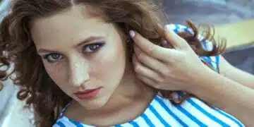 Внимание – пигментни петна! Как да се отървем от тях и защо се появяват?! 2