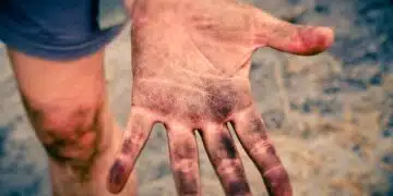 длан