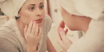 Ето с какво са свързани обривите по лицето според опитен козметолог 5