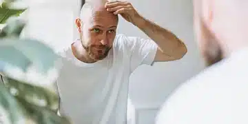 Ето на какво се дължи оплешивяването при мъжете 5