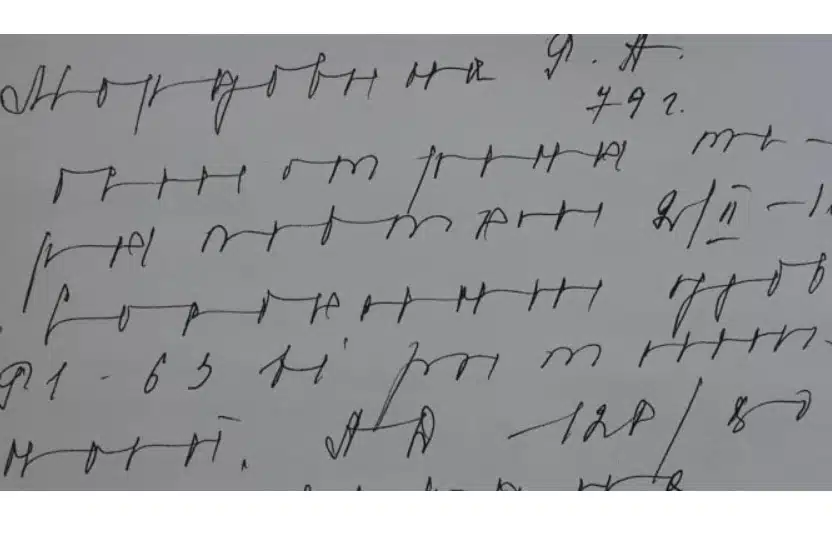 Графолог издаде тайните на нечетливия почерк след лекарите 1