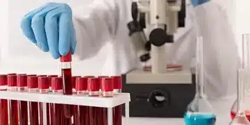Ако ръцете ви са постоянно студени, това може да е причината 3
