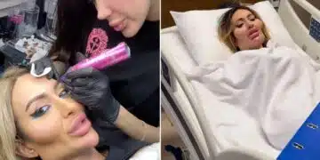 36 годишна жена стана жертва на пластичната хирургия – има импланти дори в лицето си 1