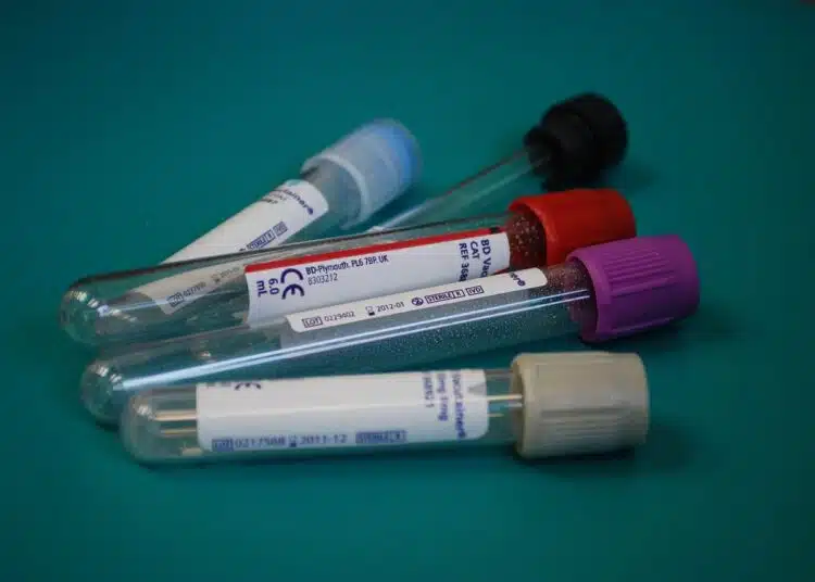 Хранене според кръвната група: Истината или опасна лъжа? 1 laboratory