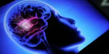 Мозъчният чип Neuralink на Илон Мъск не функционира правилно: имплантът даде дефект 11