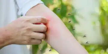 Доктор предупреди за опасни гадинки в България, които носят опасни болести 10