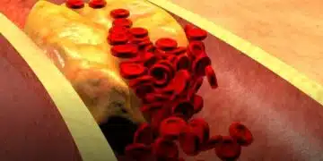 Всеки трябва да знае! Храни които трябва да консумираме, за да чистим кръвта от холестерола 11