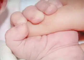 Случай 1 на 44 милиарда, жена роди 6 бебенца, заченати са естествено 6