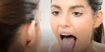 Ако езикът ви е бял, трябва ли да посетите лекар? 5
