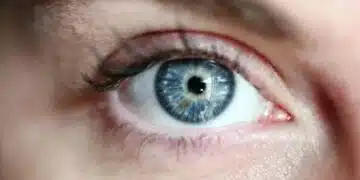 Как да се отървете от бръчките около очите и да запазите кожата си млада: 3 експертни съвета 7