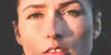 Как да се отървете от лющещата се кожа през зимата 3