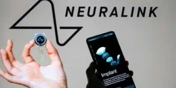 Компанията на Мъск Neurlink търси доброволци за имплантиране на чипове в мозъка: кой може да влезе в програмата 2