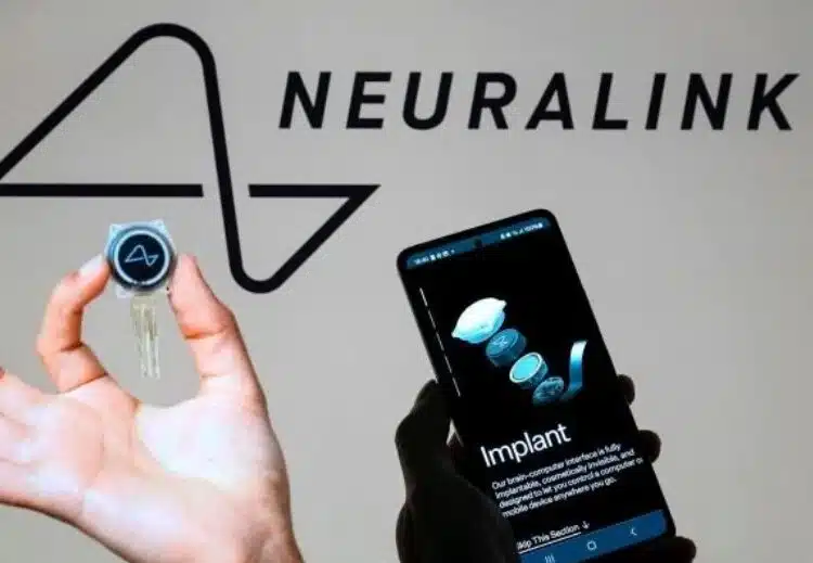 Компанията на Мъск Neurlink търси доброволци за имплантиране на чипове в мозъка: кой може да влезе в програмата 1 Компанията на Мъск Neurlink търси доброволци за имплантиране на чипове в мозъка: кой може да влезе в програмата 1