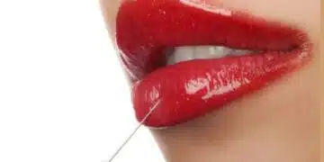5 мита за инжекциите в устните: Вярвате или не? 3