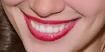 Не пренебрегвайте тези звуци от тялото си: Те може да са признак за сериозни проблеми 11