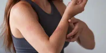 Жена се чеше по ръката.