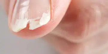Какво означава да сънуваш счупен нокът? 3