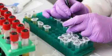 Университети във Варна организират безплатни тестове за ХИВ/СПИН 1